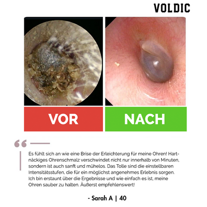 Voldic™ Elektrisches Ohrwachs-Entfernungsset