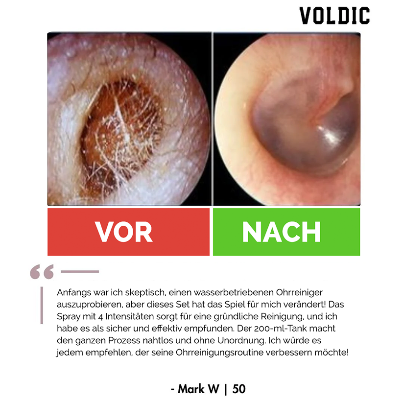 Voldic™ Elektrisches Ohrwachs-Entfernungsset