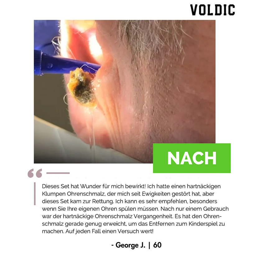 Voldic™ Elektrisches Ohrwachs-Entfernungsset