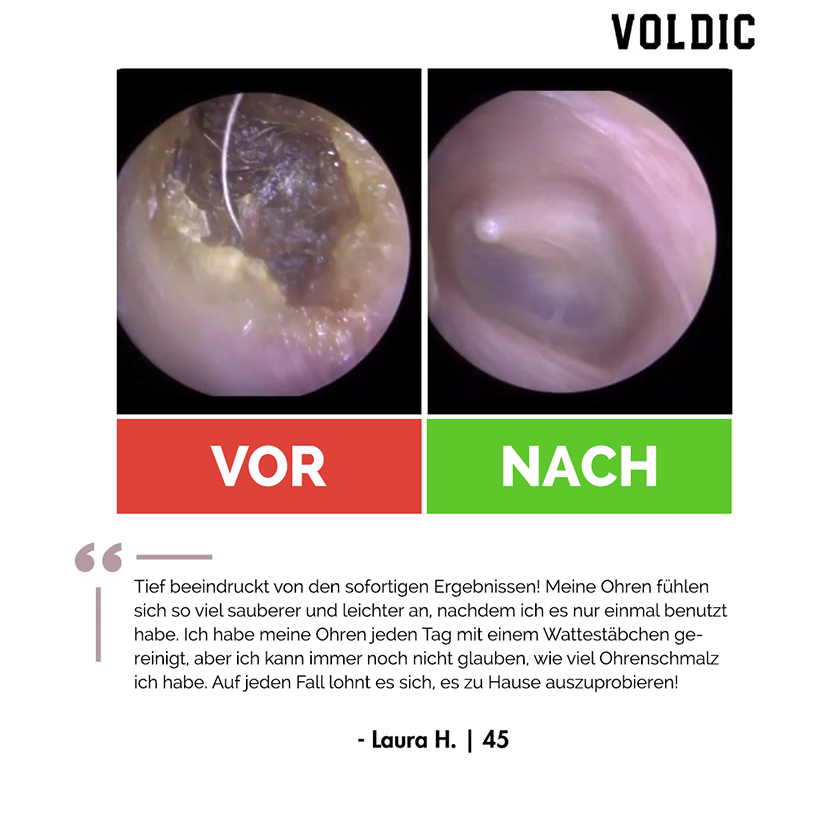 Voldic™ Elektrisches Ohrwachs-Entfernungsset